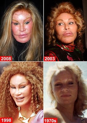 wildenstein2.jpg